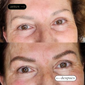 Antes y después micropigmentación en badalona