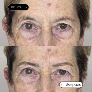 antes (1080 x 1080 px) (1)