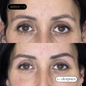 antes (1080 x 1080 px)