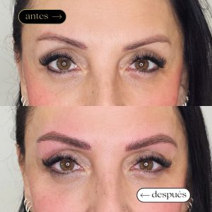 Antes y después micropigmentación en badalona